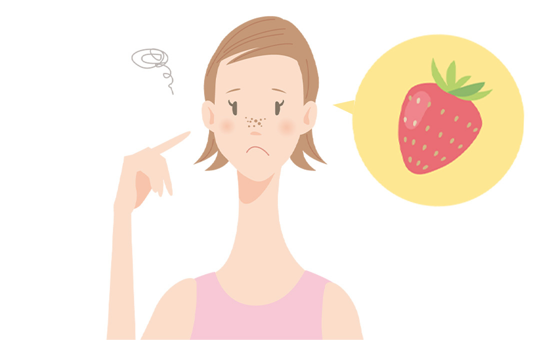 イチゴ鼻に悩む女性